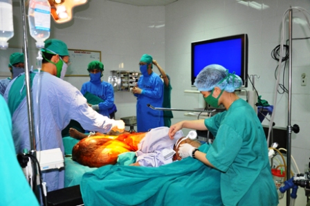 Bóc tách khối u hàng chục kg cho một phụ nữ 2