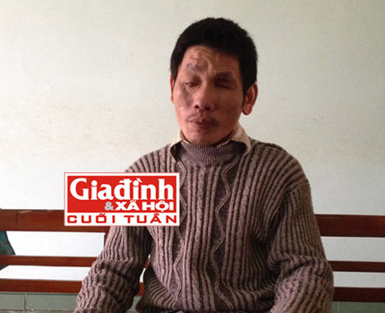 Nghị lực phi thường vượt qua số phận của người đ&agrave;n &ocirc;ng m&ugrave; tự tay đ&oacute;ng gạch để x&acirc;y nh&agrave;  2