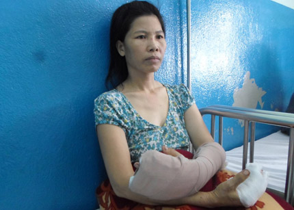 Hoang mang tin đồn &ldquo;chặt tay cướp t&agrave;i sản&rdquo; giữa phố ở S&agrave;i th&agrave;nh 1