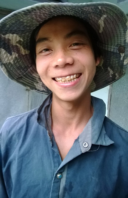 Những chuyện cười ra nước mắt ở "làng sún răng" 2