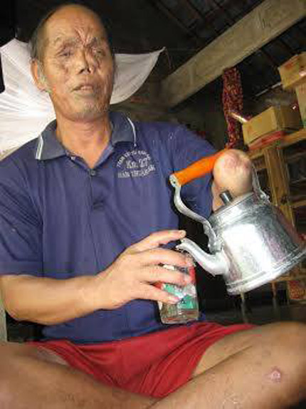 T&igrave;nh y&ecirc;u 35 năm của &ldquo;hoa kh&ocirc;i l&agrave;ng&rdquo; với người đ&agrave;n &ocirc;ng t&agrave;n phế 2