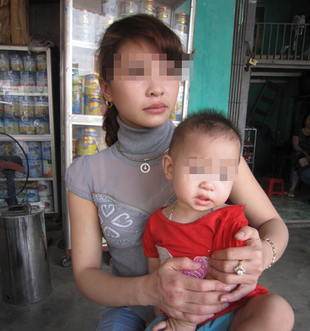Cắt gân tay mẹ, xịt cay ngất con 1 Cắt gân tay mẹ, xịt cay ngất con 1