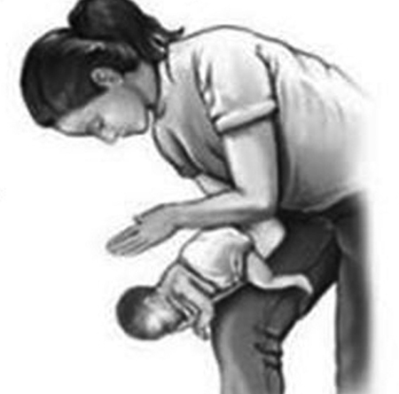 Sơ cứu đúng cách với dị vật đường thở 1