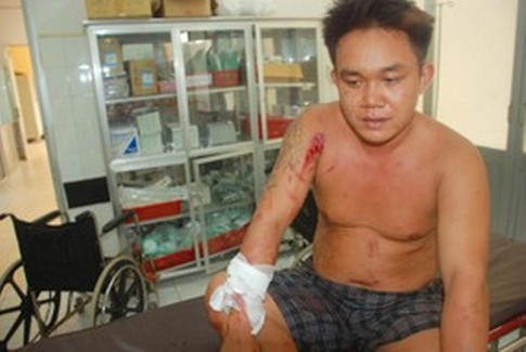 Truy tố ấp trưởng cầm đầu nh&oacute;m c&ocirc;n đồ ch&eacute;m người 1