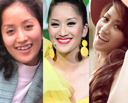 Cho&aacute;ng với nụ cười thật của mỹ nh&acirc;n Việt 2