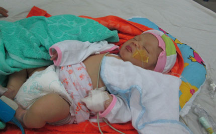 20 triệu đồng khẩn cấp đến với bé 7 ngày tuổi thoi thóp trong trái tim lỗi nhịp  2