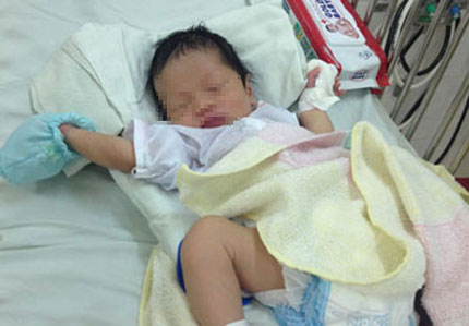 Cắn đứt ng&oacute;n tay trẻ sơ sinh cho...dễ nu&ocirc;i 1