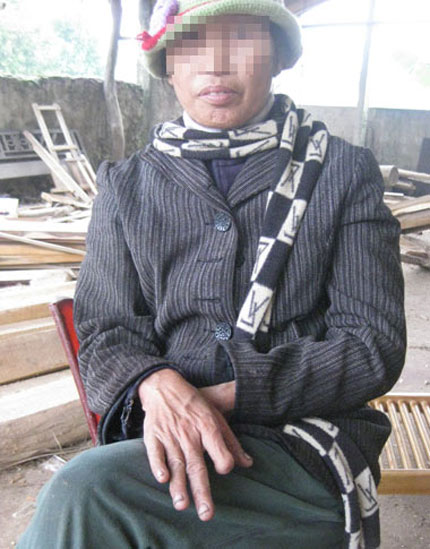 Cắn đứt ng&oacute;n tay trẻ sơ sinh cho...dễ nu&ocirc;i 2