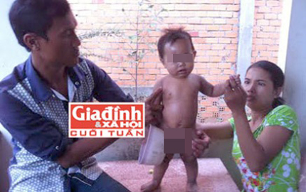 Cậu b&eacute; vừa sinh ra đ&atilde; mang h&igrave;nh th&ugrave; kỳ lạ 1