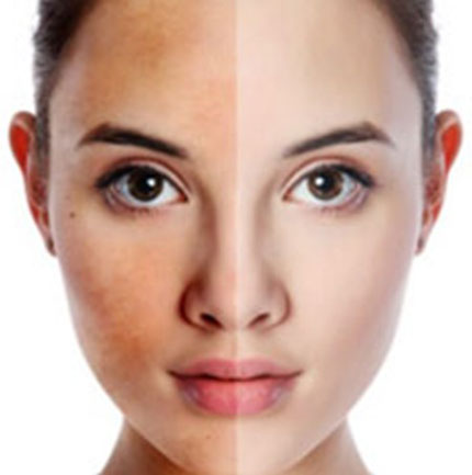 Giải ph&aacute;p cải thiện l&agrave;n da từ b&ecirc;n trong 1