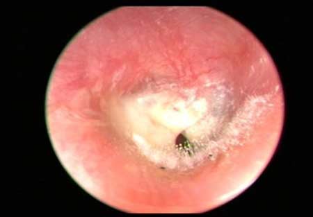 D&iacute;nh bệnh v&igrave; &ldquo;th&uacute; vui&rdquo; từ tiệm hớt t&oacute;c 2