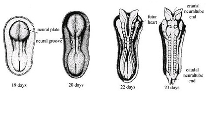Cách ngăn ngừa dị tật ống thần kinh thai nhi 2 Cách ngăn ngừa dị tật ống thần kinh thai nhi 2