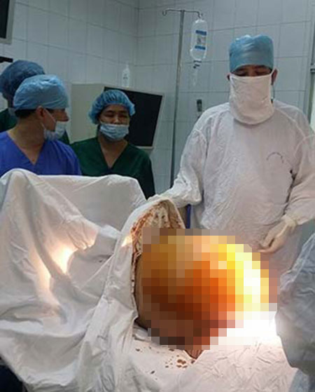Con dâu mang khối u khủng 23kg: Mẹ chồng hụt hẫng 1 Con dâu mang khối u khủng 23kg: Mẹ chồng hụt hẫng 1