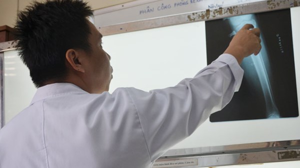 Cực h&igrave;nh để c&oacute;... ch&acirc;n d&agrave;i 1