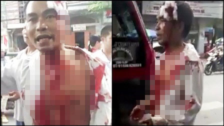 Phẫn nộ cảnh h&agrave;nh kh&aacute;ch bị nh&agrave; xe h&agrave;nh hung m&aacute;u chảy đầm đ&igrave;a 1