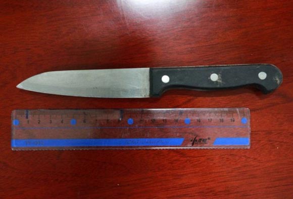 Kỳ lạ bị dao cắm s&acirc;u v&agrave;o đầu hơn 10 cm vẫn đi lại, n&oacute;i cười 5