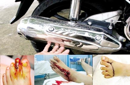 "Hậu" những vụ tai nạn kinh ho&agrave;ng do nắp p&ocirc; xe m&aacute;y: Sự thờ ơ đến kinh ngạc 2