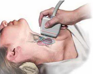 Đối ph&oacute; với bệnh bướu cổ  2