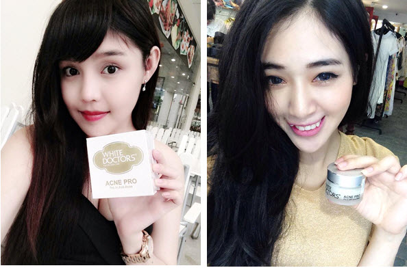 Liệu tr&igrave;nh điều trị da mặt bị mụn, th&acirc;m, sẹo hiệu quả  3