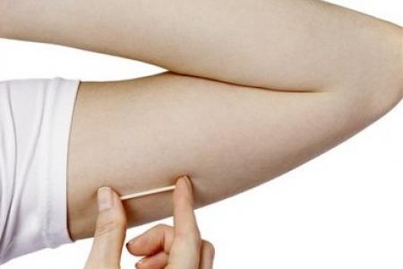 Que cấy tranh thai: c&oacute; thực sự an to&agrave;n với phụ nữ đang cho con b&uacute;?  1