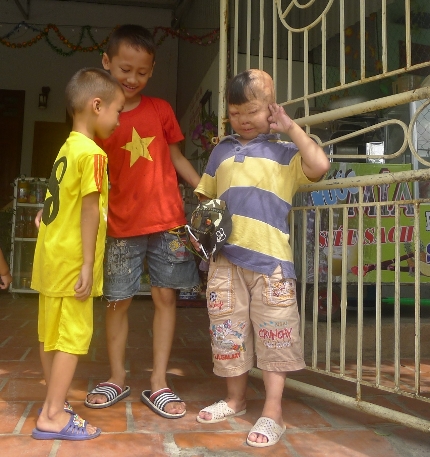 Nghẹn l&ograve;ng cảnh sinh hoạt đời thường ch&aacute;u b&eacute; bị cha đốt 3 năm về trước 10