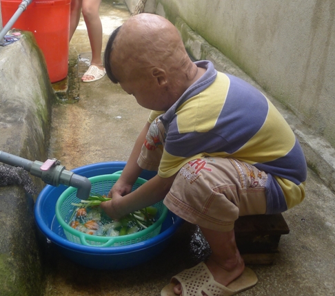 Nghẹn l&ograve;ng cảnh sinh hoạt đời thường ch&aacute;u b&eacute; bị cha đốt 3 năm về trước 6