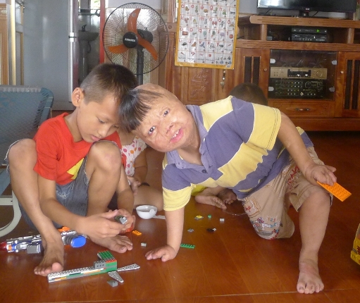Nghẹn l&ograve;ng cảnh sinh hoạt đời thường ch&aacute;u b&eacute; bị cha đốt 3 năm về trước 8