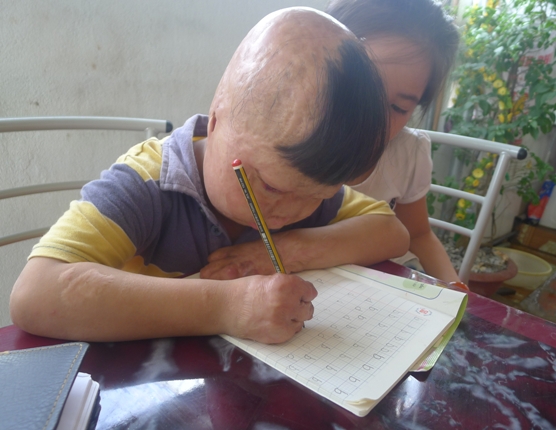 Nghẹn l&ograve;ng cảnh sinh hoạt đời thường ch&aacute;u b&eacute; bị cha đốt 3 năm về trước 7