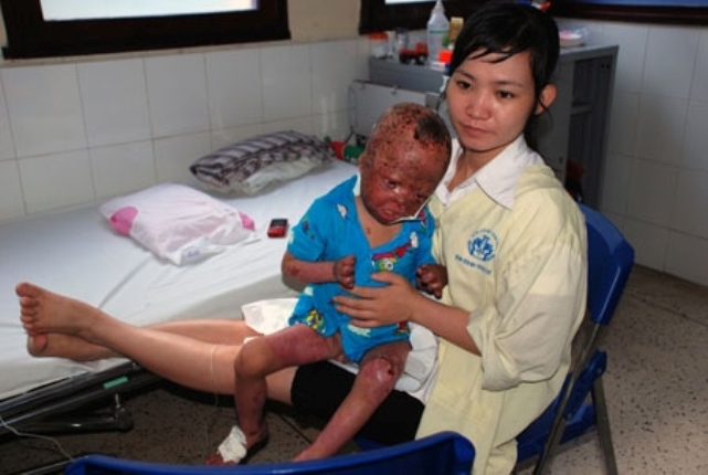 Nghẹn l&ograve;ng cảnh sinh hoạt đời thường ch&aacute;u b&eacute; bị cha đốt 3 năm về trước 3