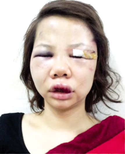 Bất lực nh&igrave;n con g&aacute;i bị đ&aacute;nh v&igrave; sợ rể trả th&ugrave; 2