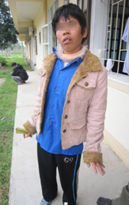 Tiếp nghi án hiếp dâm người tâm thần tại Nghệ An: Khi Trưởng Công an xã “thỏa thuận” tại nhà riêng 2 Tiếp nghi án hiếp dâm người tâm thần tại Nghệ An: Khi Trưởng Công an xã “thỏa thuận” tại nhà riêng 2