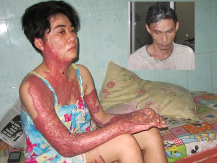 Vụ chồng tạt xăng đốt vợ vì máu đỏ đen: Tâm sự đắng lòng của người vợ 1