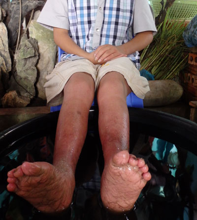 Sự thật về cậu bé có đôi chân bốc hoả và khả năng chữa bệnh siêu nhiên 2