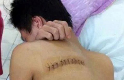 Truy tìm nhóm sát thủ chém rách lưng một sinh viên 1