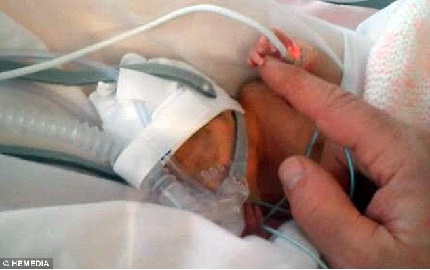 Sức sống kì diệu của bé gái nhỏ bằng một bàn tay người lớn 2 Sức sống kì diệu của bé gái nhỏ bằng một bàn tay người lớn 2