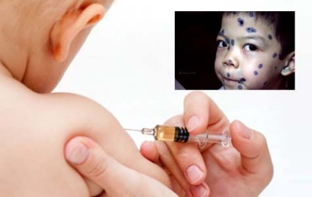 V&igrave; sao hết một số vaccine ti&ecirc;m dịch vụ? 1