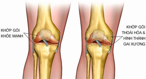 Bảo Thanh Đường: Nơi chữa trị c&aacute;c bệnh khớp uy t&iacute;n 1