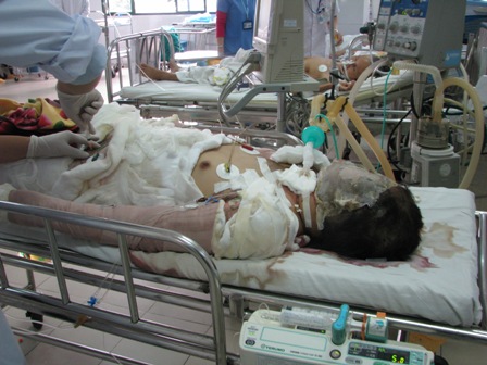 Thiếu nữ bị chém rồi thiêu sống ở Đà Nẵng đã qua đời 1