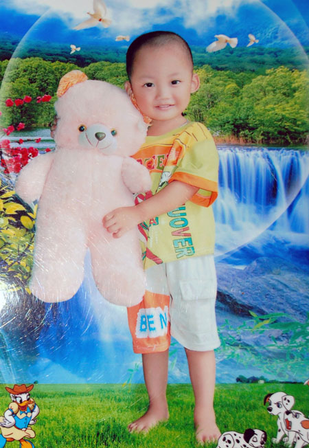 B&eacute; 3 tuổi bị bố đẻ tưới xăng đốt giờ ra sao? 1