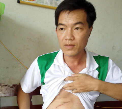 Người t&igrave;nh xẻo tai Ph&oacute; b&iacute; thư x&atilde; xin được b&atilde;i nại 1