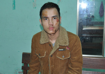 Kinh ho&agrave;ng nam thanh ni&ecirc;n gặp ai cũng ch&eacute;m 1