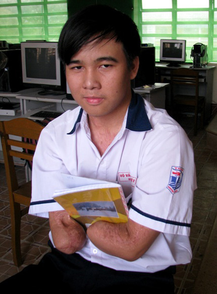 Cảm phục nghị lực cậu học tr&ograve; viết chữ bằng ch&acirc;n 2