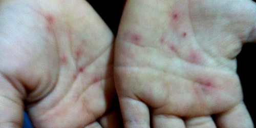 Kh&ocirc;ng thể kết luận c&ocirc; gi&aacute;o đ&acirc;m kim v&agrave;o tay b&eacute; mầm non 1