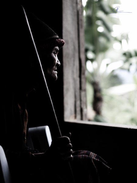 X&oacute;t xa trước nỗi đau da cam ở A Lưới 3