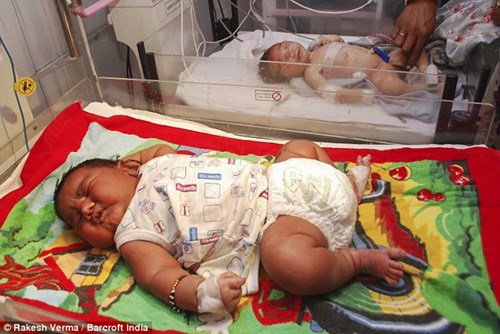 
Em bé có cân nặng 5,89 kg chào đời tại bệnh viện chính phủ ở Sri Ganganagar, Rajasthan, Ấn Độ.
