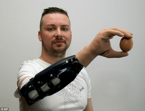
Bệnh nhân sử dụng cánh tay giả để cầm trứng. Ảnh: AP.
