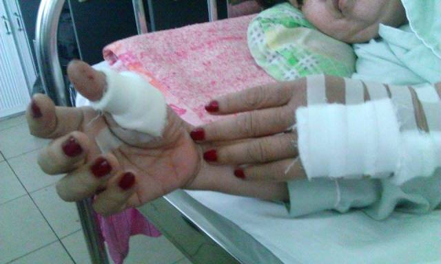 
B&agrave; H. vẫn đang nằm viện điều trị với nhiều vết thương do chồng ch&eacute;m
