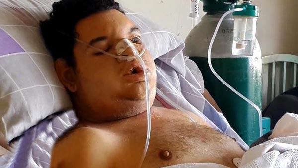 
Orlando Jimenez đang được điều trị ở bệnh viện. Ảnh: CEN
