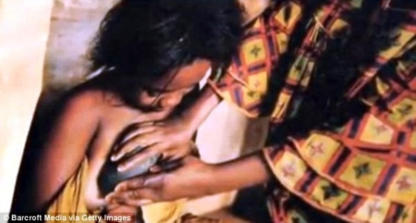 
Một bé gái tại Cameroon đang được “ủi ngực” bởi mẹ của mình.
