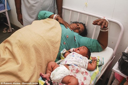 
Mẹ bé - chị Goga Bai (25 tuổi) bị bệnh tiểu đường và nặng tới 100 kg - đây có thể là nguyên nhân dẫn đến việc em bé sinh ra có cân nặng quá mức như vậy.
